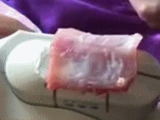 "Phương pháp 'trẻ hóa âm đạo' không đau: Khám phá quy trình đầy thú vị!" Sử dụng bao cao su