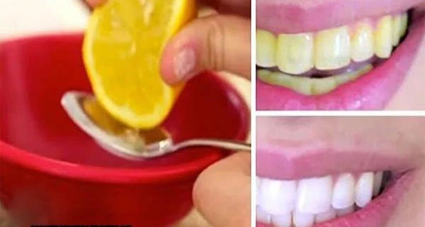 Chỉ cần 1 quả chanh, răng trắng và chân đẹp tức thì! làm trắng răng
