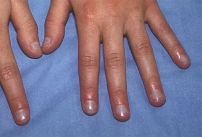 14 Dấu Hiệu Trên Móng Tay Cho Thấy Bạn Có Thể Bị Bệnh Chẩn đoán