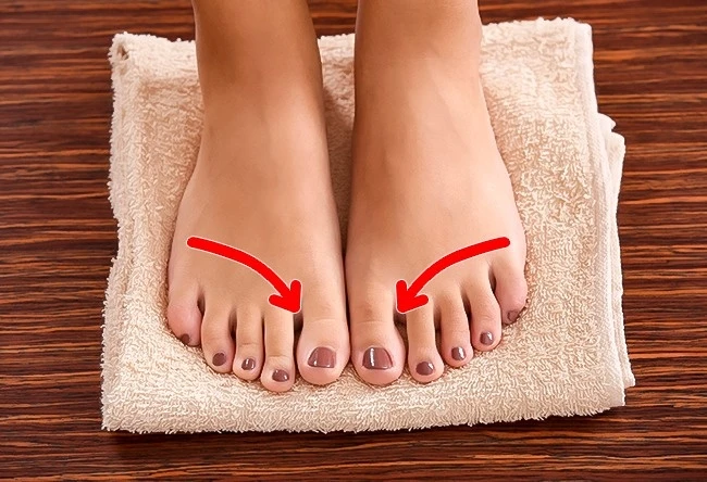 Các bệnh phổ biến ở chân mùa hè và phương pháp xử lý đơn giản nhất tổn thương chân
