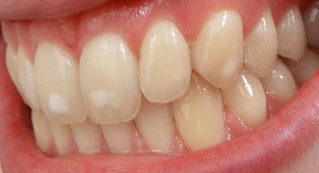 10 dấu hiệu trên cơ thể cảnh báo tình trạng sức khỏe mà bạn không nên bỏ qua. dấu hiệu sức khỏe