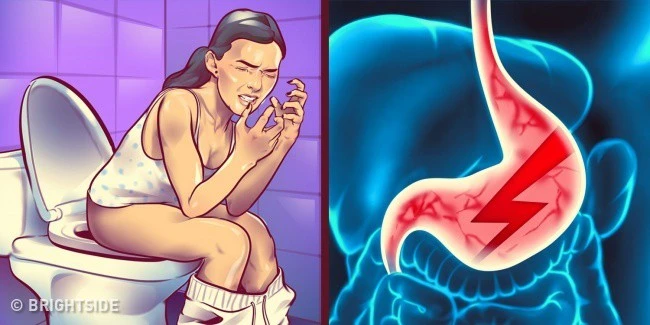 9 Dấu Hiệu Cảnh Báo Rằng Cơ Thể Bạn Có Thể Gặp Vấn Đề Với Việc Tiêu Hóa Thịt Bạn Đã Ăn tiêu hóa thịt không đúng cách