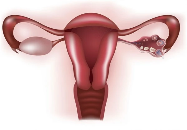 Nguyên Nhân Dẫn Đến Lão Hóa Sớm Của Buồng Trứng dấu hiệu