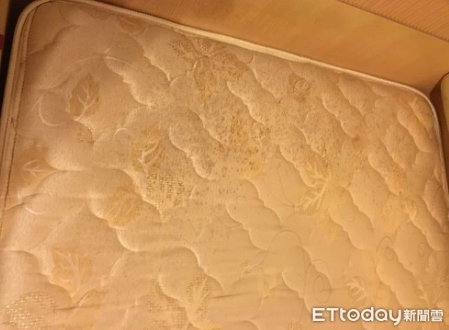 Cô bé 7 tuổi mắt sưng và miệng có mùi khó chịu, bác sĩ bối rối cho đến khi mẹ nhớ ra vị trí ngủ của con. viêm mũi dị ứng