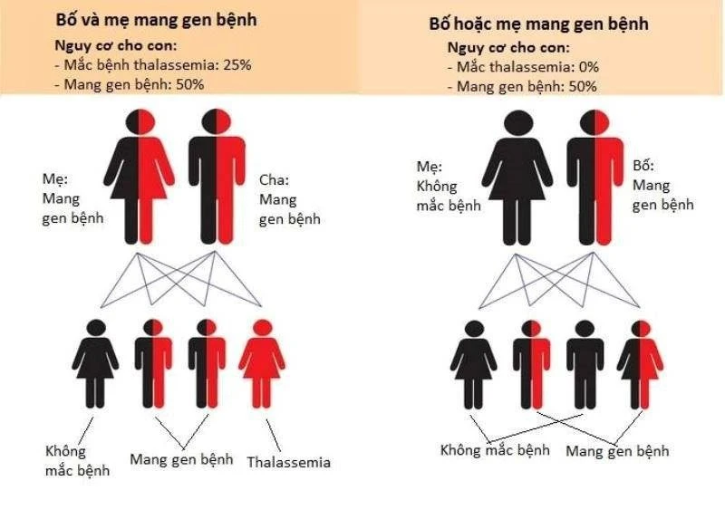 Thalassemia - Bệnh lý gây thiếu máu nhưng lại dẫn đến tình trạng thừa sắt bẩm sinh ở trẻ em. bệnh Thalassemia